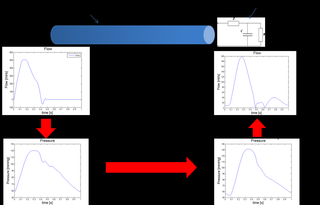 Έρνληαο ινηπφλ ππνινγίζεη ην ζπλνιηθφ input impedance (Ε) άιια θαη ην pressure ratio γηα θάζε πηζαλή δηαδξνκή ηνπ αξηεξηαθνχ δέληξνπ, κπνξνχκε λα εηζάγνπκε απφ ην ζεκείν ηεο θαξδηάο κηα ξνή (