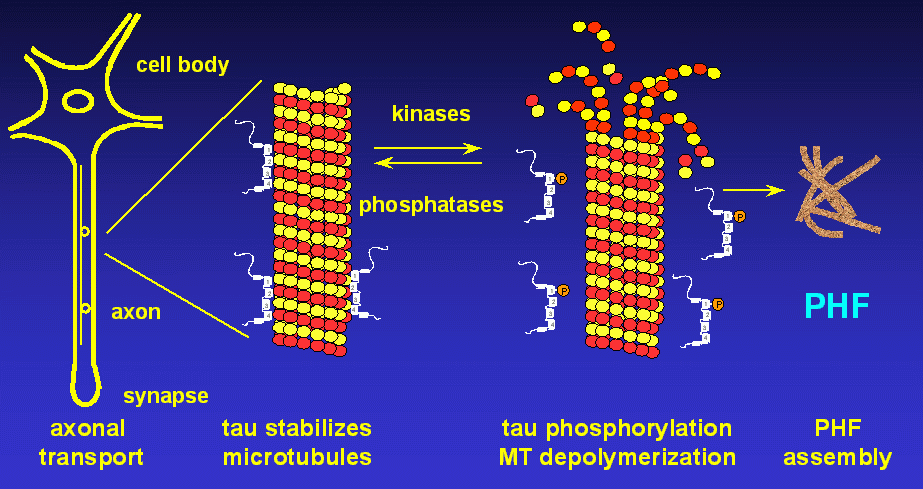 Εικόνα 7: Υπερφωσφορυλίωση της πρωτεΐνης tau και νευροτοξικότητα (http://www.mpasmb-hamburg.mpg.de/webpage_tau/hypothese.