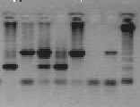 ΑΠΟΤΕΛΕΣΜΑΤΑ Πολυµορφισµός tau I/D Μετά από εφαρµογή της PCR και την ηλεκτροφόρηση των προϊόντων σε πηκτή αγαρόζης 2,5% προέκυψαν τρία διαφορετικά πρότυπα ζωνώσεων, το µέγεθος των οποίων υπολογίστηκε