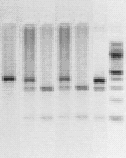 A B Γ Ε Ζ Η 385 bp 287 + 98 bp Εικόνα 23: Πρότυπο ζωνώσεων µετά από πέψη των προϊόντων PCR µε το ένζυµο περιορισµού XhoI και ηλεκτροφόρηση σε πηκτή αγαρόζης (πολυµορφισµός tau rs242562).