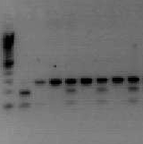 A B Γ Ε Ζ Η Θ Ι 287bp 190bp Εικόνα 27: Πρότυπο ζωνώσεων µετά από πέψη των προϊόντων PCR µε το ένζυµο περιορισµού Hpy188I και ηλεκτροφόρηση σε πηκτή αγαρόζης (πολυµορφισµός GSK-3b rs6438552).