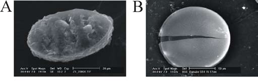 846 8ο Πανελλήνιο Συμποσιο Ωκεανογραφίας & Αλιείας Fig. 3. A) SEM micrograph of a diatom frustule buried in the delta front station MT1, (depth 1-2cm).