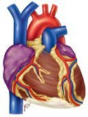 Inferior Infarct with ST