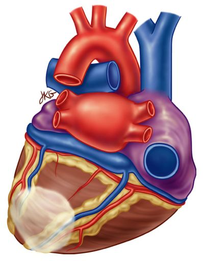 Reciprocal changes The posterior aspect of the heart is viewed as