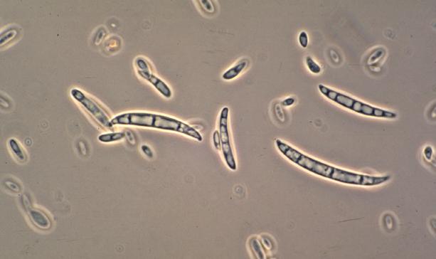 (Υποφύλο), Sordariomycetes (Κλάση), Hypocreomycetidae (Υποκλάση), Hypocreales (Τάξη), Fusarium (Γένος), Fusarium oxysporum (Είδος) [NCBI].