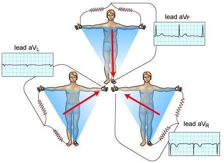 Ενισχυμένες Απαγωγές avl = Vla (Vra+Vll)/2