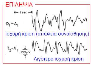 Τα ΗΕΓ χρ