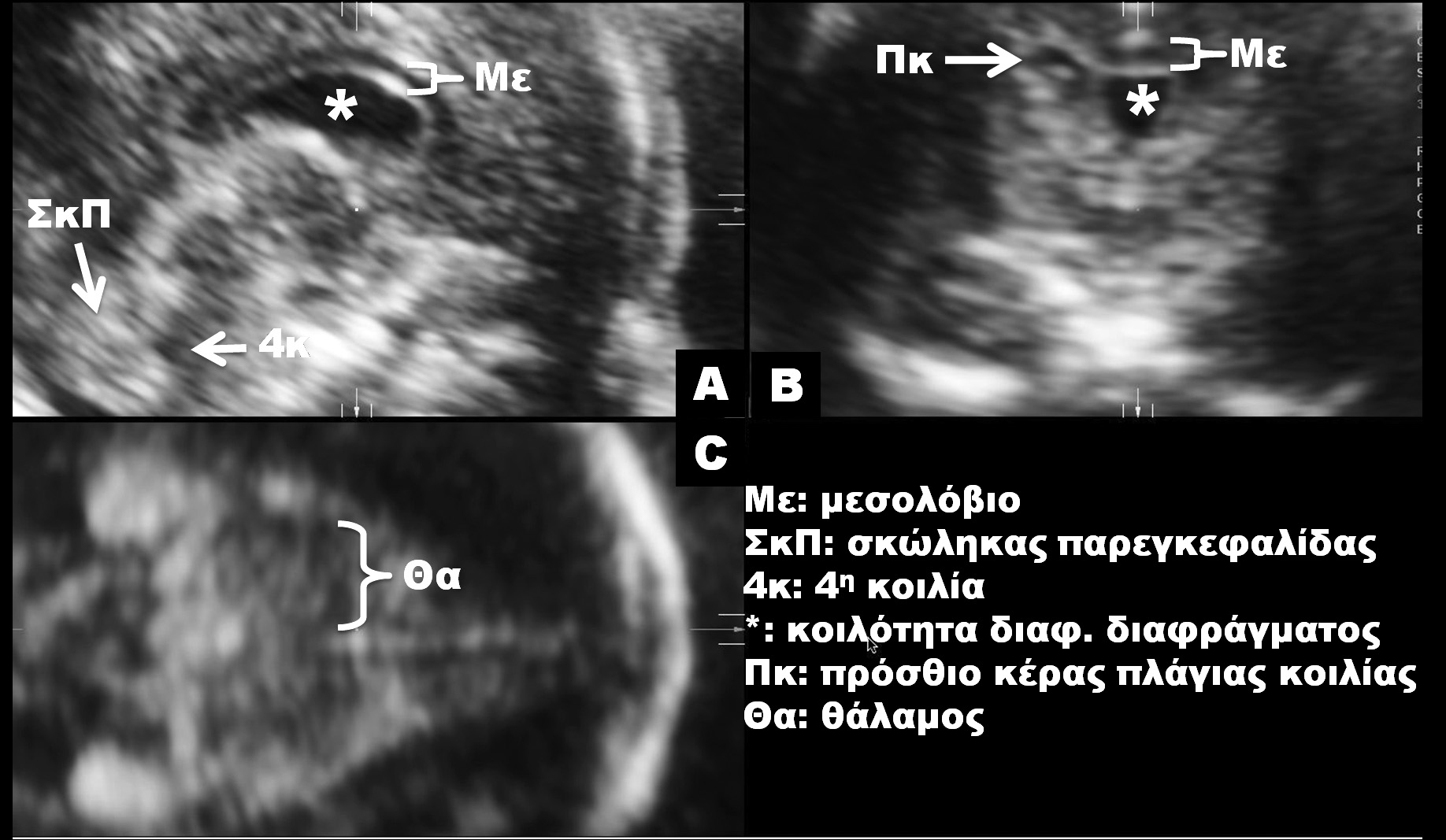 Υπερηχογράφημα κεντρικού νευρικού συστήματος Σωτηριάδης Α. δομένων από το όργανο ενδιαφέροντος την επεξεργασία των δεδομένων σε δεύτερο χρόνο ή την αποστολή τους σε άλλους εξεταστές.