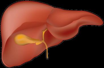 Hepatic insulin resistance Hepatic glucose output Small, dense LDL Intra-abdominal adiposity Portal circulation FFA TG-rich VLDL cholesterol Lipolysis CETP, Lipolysis Low HDL cholesterol Systemic