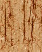 50. Tο νευρικό σύστημα Ο νευρίτης και οι δενδρίτες έχουν τυπικό μέγεθος γύρω στο 1μm (1 μικρόμετρο, δηλαδή 1 εκατομμυριοστό του μέτρου), ενώ το κυτταρικό σώμα έχει διάμετρο γύρω στα 25 μm.