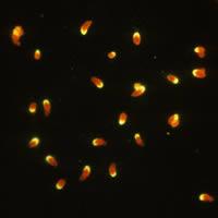 A: Formalin-fixed Toxoplasma gondii tachyzoites, stained by immunofluorescence (IFA).