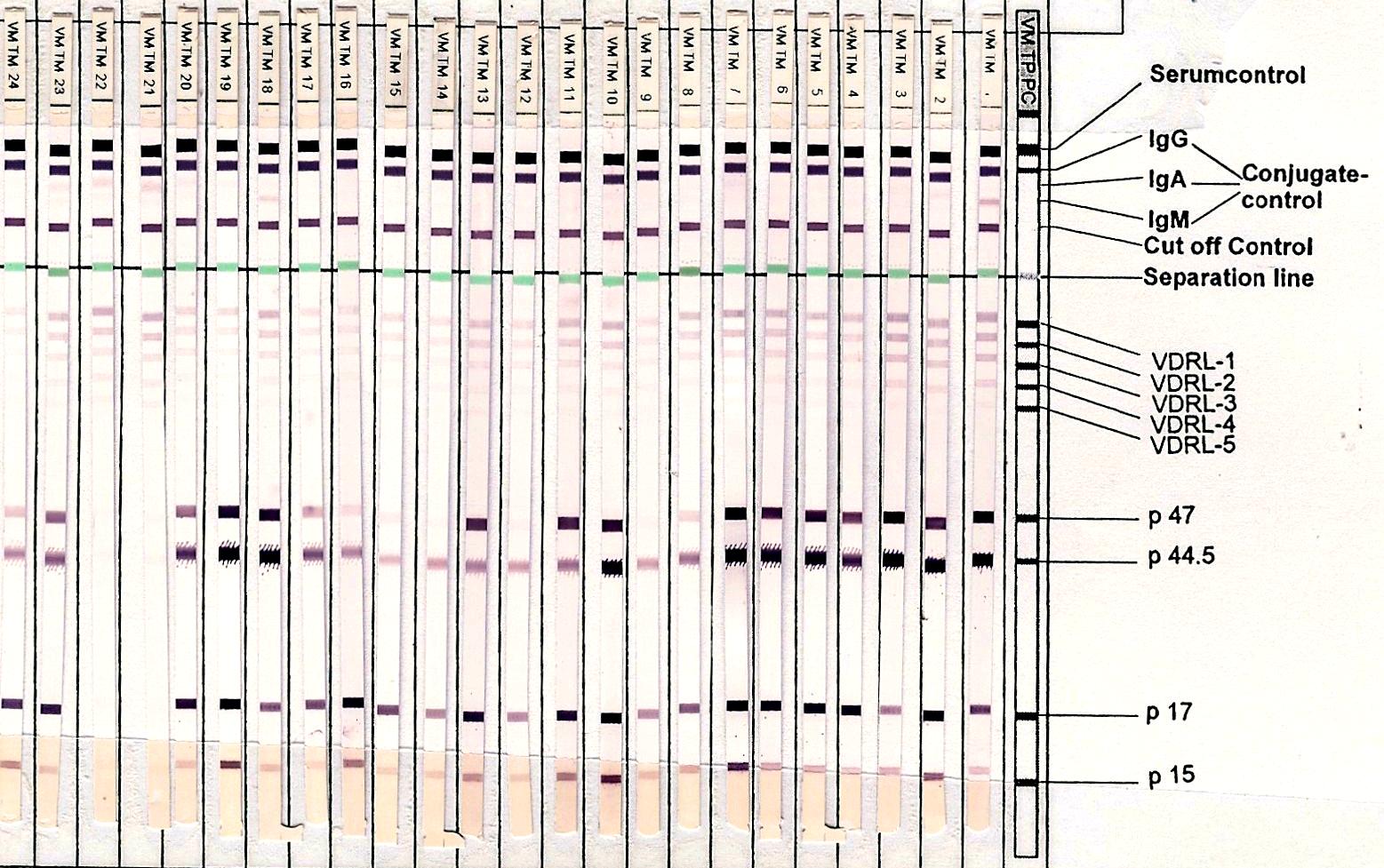 Ανοσοαποτύπωση Western-Blot