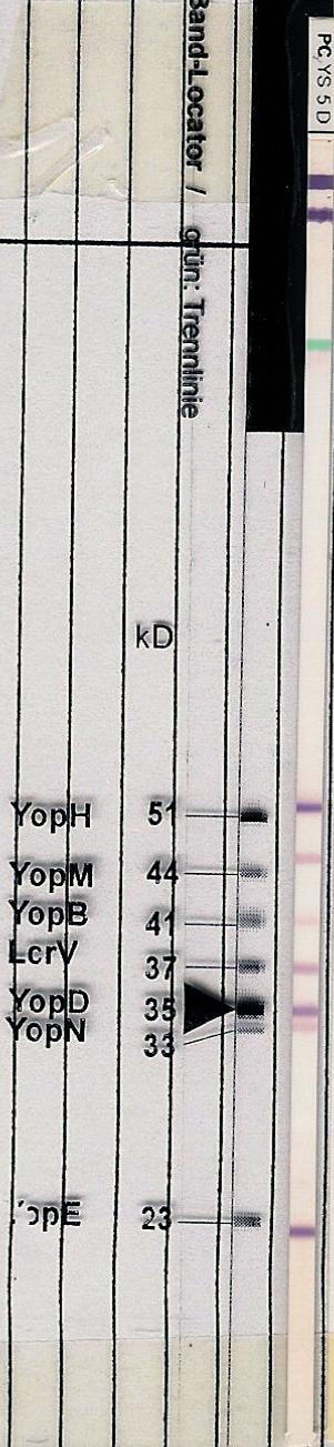 Ανοσοαποτύπωση Western-Blot (WB) Characteristics of Yersinia ViraBlot Bands YopH: 51 kd, protein-tyrocin-phosphatase, involved in signal tranduction, in combination with YopE bloking of