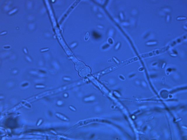 Παρασκεύασμα με χλαμυδοσπόρια Fusarium oxysporum