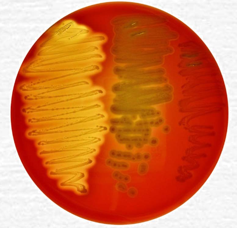 Differential Media Use of blood agar. Streptococcus pyogenes (left) completely uses red cells, producing a clear zone termed betahemolysis.