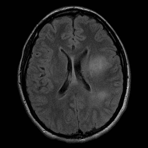 Το MRI μερικές φορές