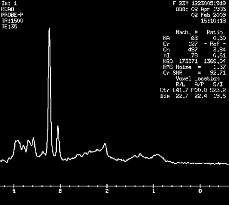 [Choline] = 10.0 mm [Cr] = 10.