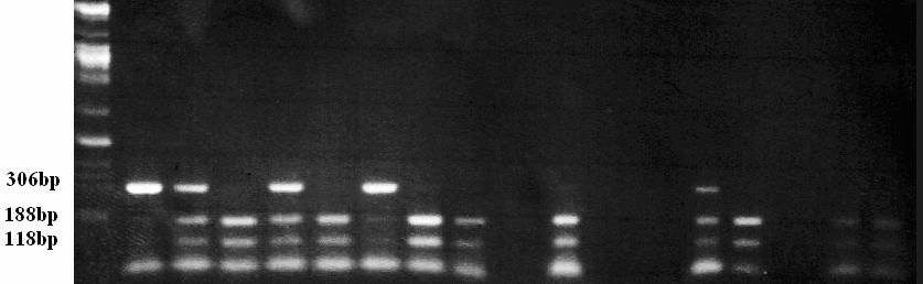 10. ΑΠΟΤΕΛΕΣΜΑΤΑ 10.1. Αποτελέσματα PCR και πέψης Η επιτυχία της αλυσιδωτής αντίδρασης πολυμεράσης στον υποκινητή του γονιδίου της COX-2 επιβεβαιώθηκε με την παρατήρηση των πηκτωμάτων αγαρόζης στο υπεριώδες.