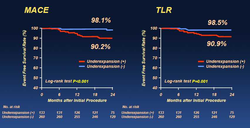 IVUS for LM PCI Kang et al.