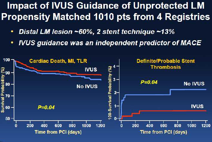 IVUS for LM PCI De la