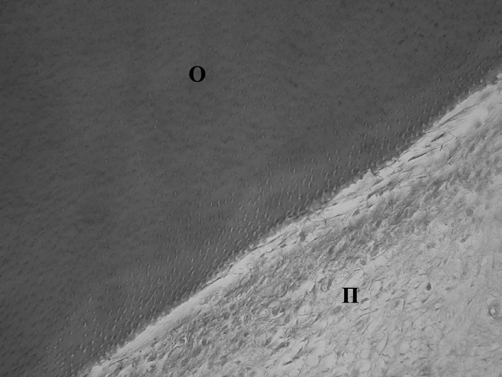 ΠΑΙΔΟΔΟΝΤΙΑ 2011 25(4): 178-183 179 Εικόνα 1.