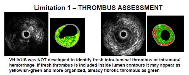 Virtual Histology