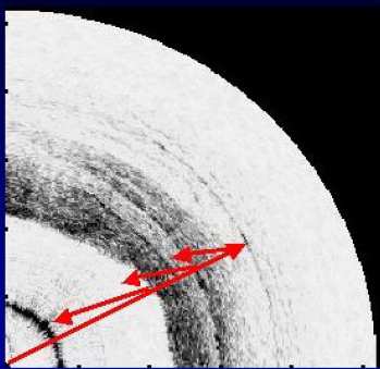 Optical Coherence Tomography Τοοπτικόανάλογοτου