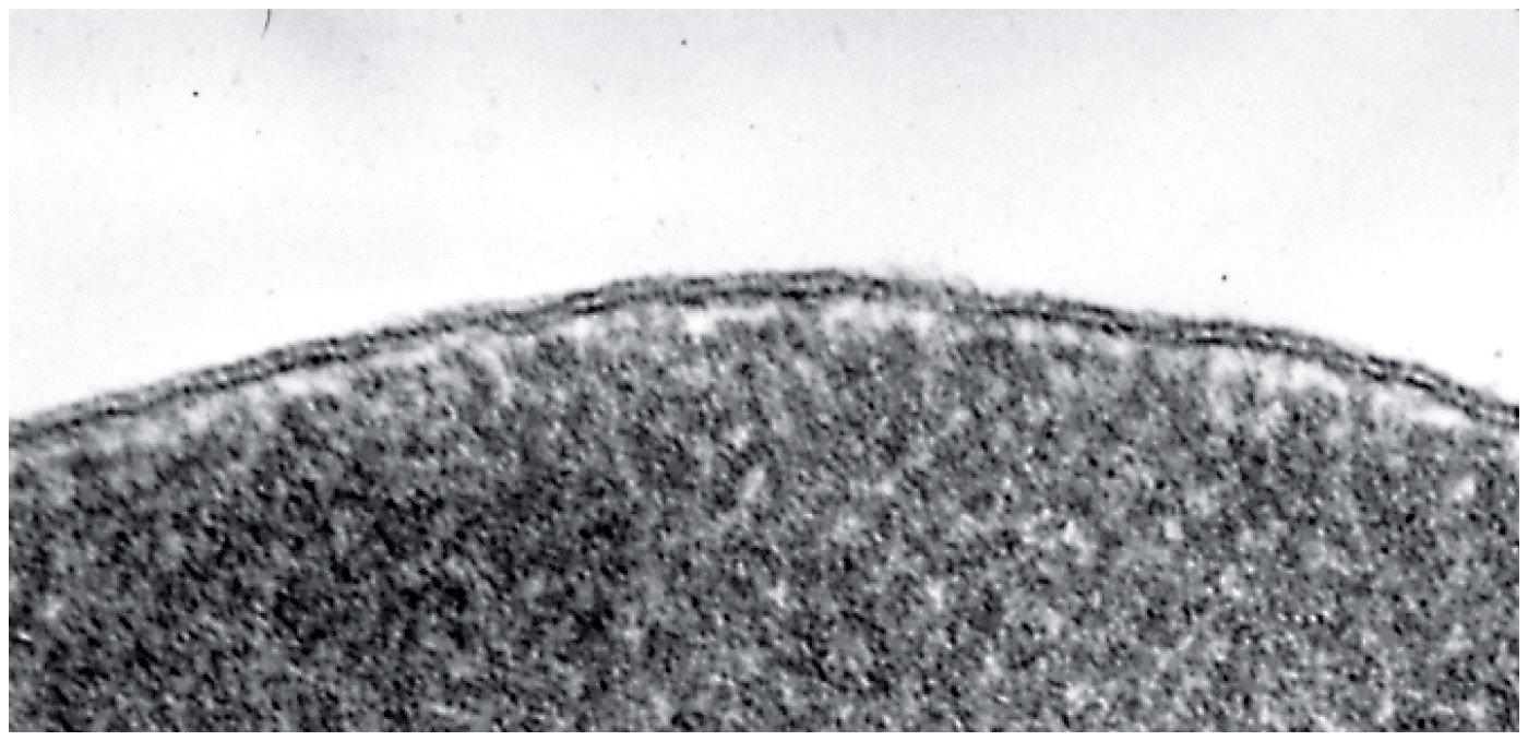 An electron micrograph of a plasma membrane (of a human red blood cell) seen in cross section.