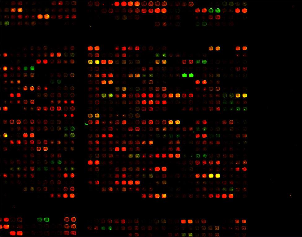 Μικροσυστοιχίες DNA (DNA microarrays) Η βασική αρχή πάνω στην οποία στηρίζονται οι μικροσυστοιχίες DNA είναι ο υβριδισμός DNA- DNA.