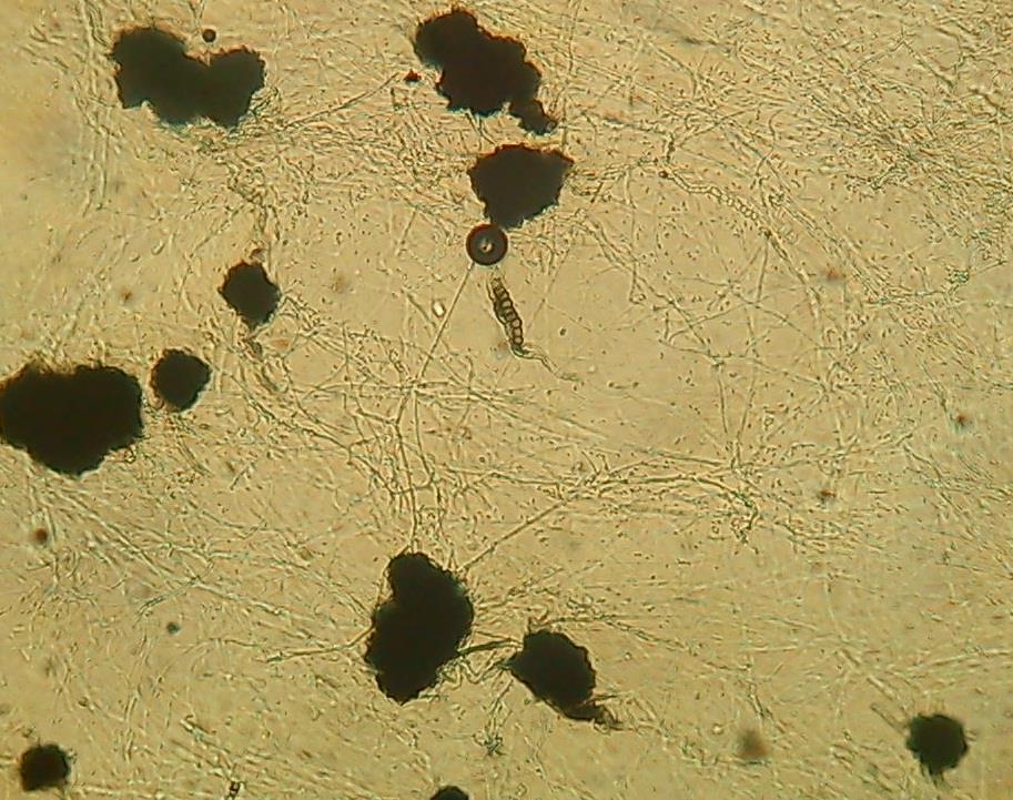 Verticillium dahliae: μικροσκληρώτια σε