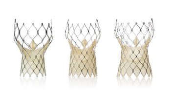 CoreValve Evolut R Μειωµένο ύψος Προς την έξοδο για καλύτερη τοποθέτηση ιδίως σε γωνιωµένη ανατοµία Διατήρηση µήκους «φούστας» Θέση της βαλβίδας στο ίδιο σηµείο στη «µεση»