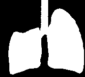 σταθμούς Ν1 & Ν2 Η Τμηματεκτομή (προτιμότερη της Σφηνοειδούς) σε ασθενείς με: Πτωχές αναπνευστ. Εφεδρείες ή άλλη συνυπάρχ.