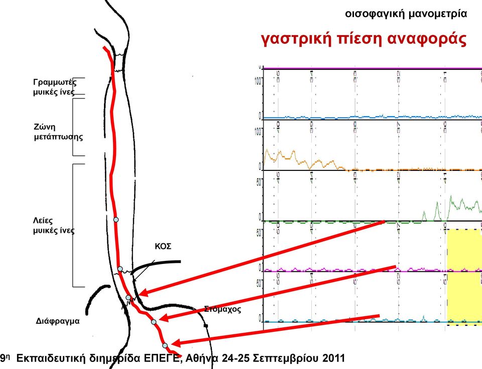 ΚΟΣ Δηάθξαγκα Σηόκαρνο 9 ε Εθπαηδεπηηθή