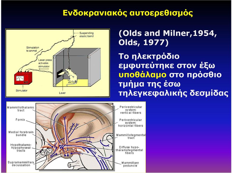 εμφυτεύτηκε στον έξω υποθάλαμο στο