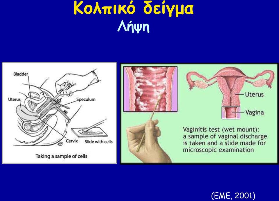 Λήρε