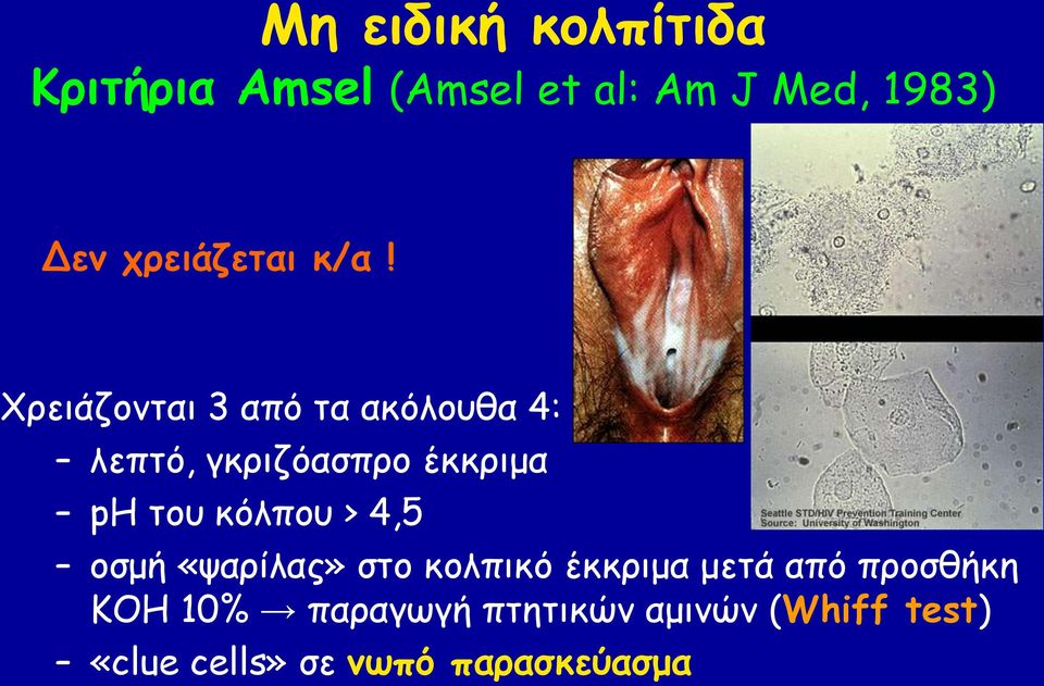 Υνεηάδμκηαη 3 από ηα αθόιμοζα 4: ιεπηό, γθνηδόαζπνμ έθθνημα ph ημο θόιπμο