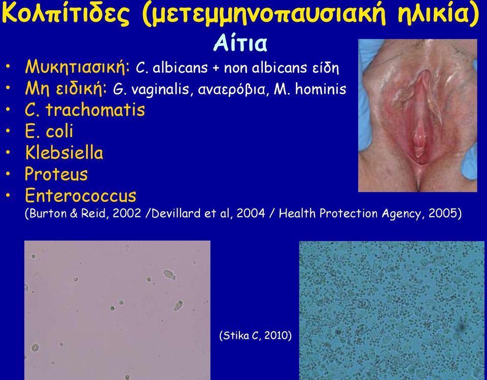 hominis C. trachomatis E.