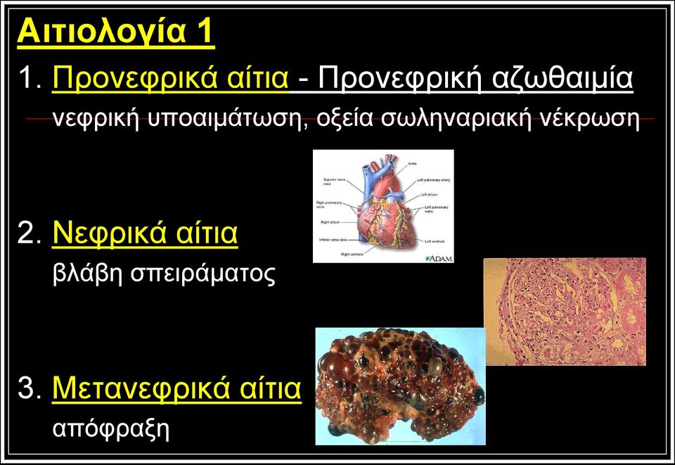 νεφρική υποαιμάτωση, οξεία σωληναριακή