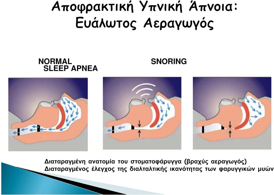 αεραγωγός) ιαταραγµένος έλεγχος της