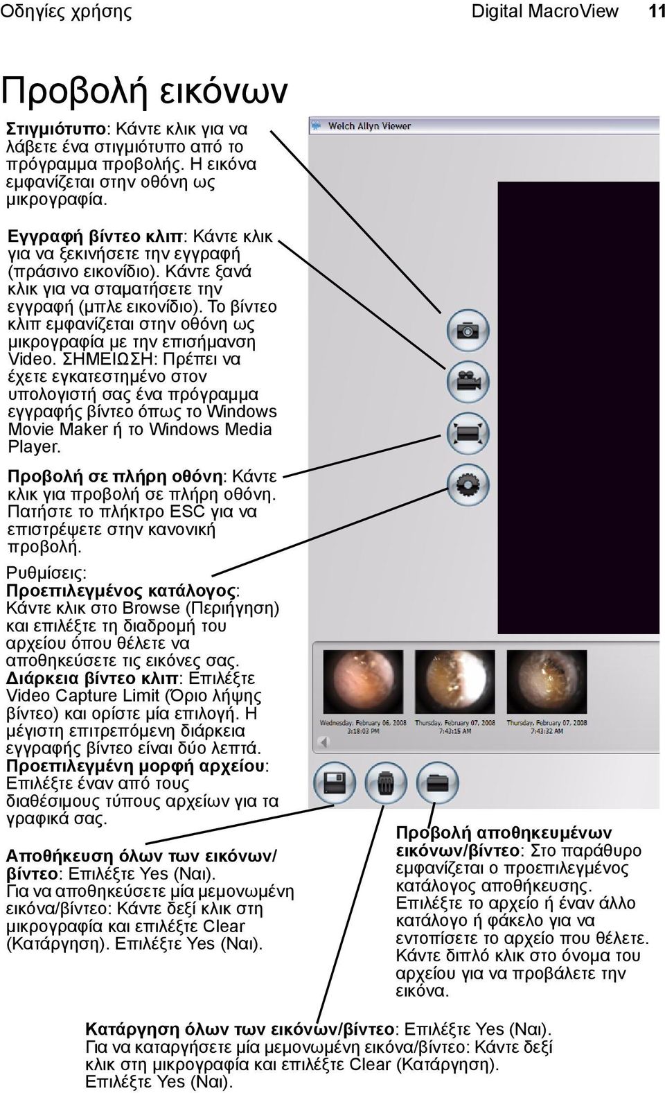 Το βίντεο κλιπ εμφανίζεται στην οθόνη ως μικρογραφία με την επισήμανση Video.