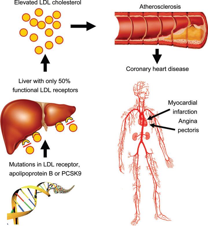 Pathophysiology of heterozygous