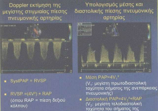 Μεηξήζεηο ΤΚ: Αιινη