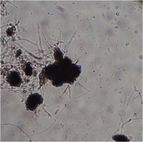 2.7 Προετοιμασία του μολύσματος Verticillium dahliae και της καλλιέργειας του μη παθογόνου μύκητα Fusarium oxysporum F2 για τα πειράματα έκκρισης πρωτεϊνών παθογένειας Έγινε καλλιέργεια του μύκητα