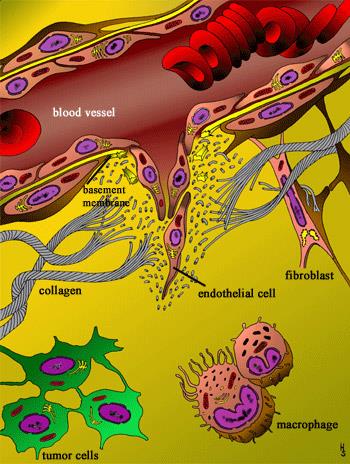 Αγγειογένεση του όγκου Έκκριση αγγειογενετικών παραγόντων (VEGF) από κύτταρα όγκου (ενδογενείς), φλεγμονώδη κύτταρα στρώματος και