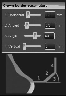 ΧΡΉΣΗ Παράμετροι ορίου στο λογισμικό CAD Φροντίζετε για επαρκή πάχη στα άκρα των τοιχωμάτων. Προτεινόμενες τιμές: _1. Πάχος άκρου (Οριζόντια): 0,2 mm _2. Γωνιασμένο (Angled): 0,3 mm _3.