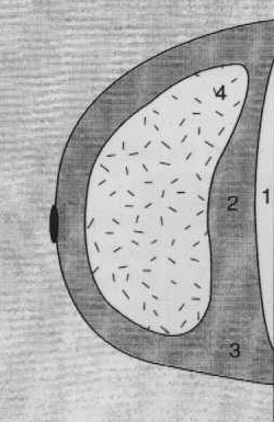 Obr. 3.: Možné konfigurácie pektorálneho svalu v MLO projekcii A = správne polohovanie, B,C,D = nesprávne polohovanie CC (kranio-kaudálna) projekcia 1. Diagnostické požiadavky: 1.1. Kritéria obrazu vo vzťahu k polohovaniu 1.