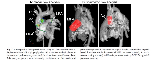 4-D flow magnetic resonance imaging: blood flow