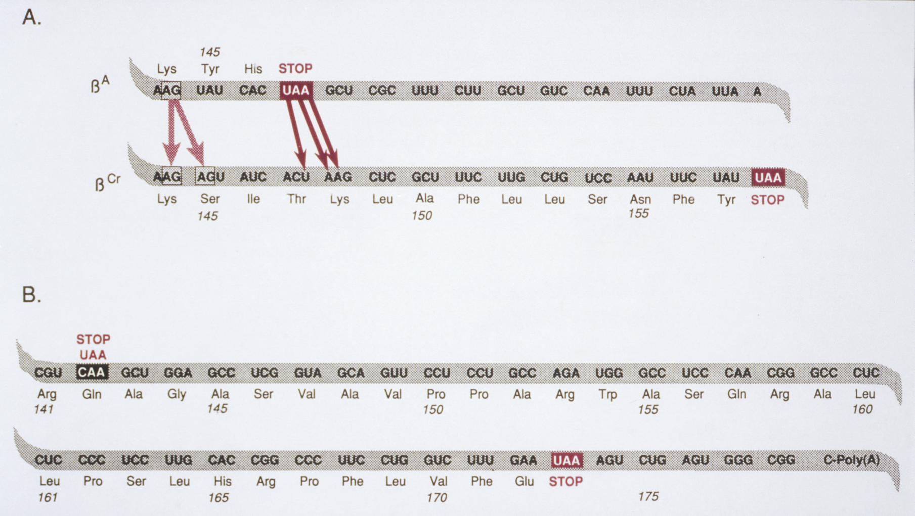 Παθολογικές αιμοσφαιρίνες λόγω μετατόπισης πλαισίου ανάγνωσης 157aa Αιμοσφαιρίνη Cranston: Ένθεση 2nt μεταξύ των κωδικονίων 144-145 στο γονίδιο β Ποιοτική