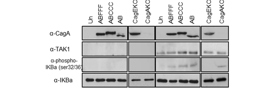Αποτελέσματα Εικόνα 46: (Α) Δόσο-εξαρτώμενη αναστολή έκκριση της IL-8, παρουσία του ειδικού αναστολέα TAK1 5Ζ-7- Oxozeaenol (5-300 nμ), μετά από 4 ώρες μόλυνση των κυττάρων AGS με το P12ABCCC