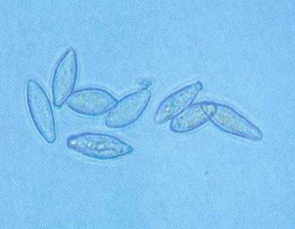 Τάξη: Pleosporales, Οικ.